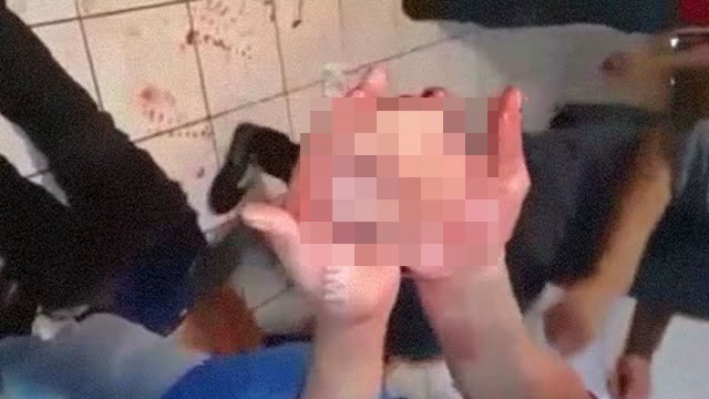 超閲覧注意 もぎたての心臓がピクピク動いてる 閲覧注意グロ動画 衝撃映像のソルカブ