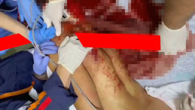 【閲覧注意】女医さん「イケるやろ！」力づくで男のアレを抜いちゃう。  |  閲覧注意グロ動画・衝撃映像のソルカブ