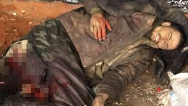 【閲覧注意】爆発で右足が吹き飛んだウクライナ兵と千切れたその足。 | 閲覧注意グロ動画・衝撃映像のソルカブ 