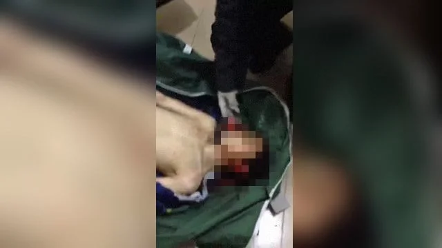 死体裸 