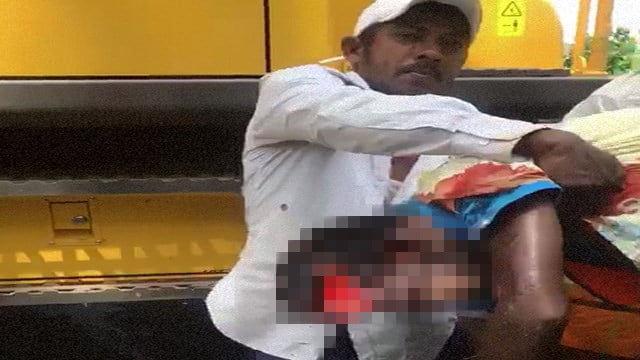 【閲覧注意】パックリ割れた頭から脳みそドロリ…中身全部置いて搬送される男。 | 閲覧注意グロ動画・衝撃映像のソルカブ