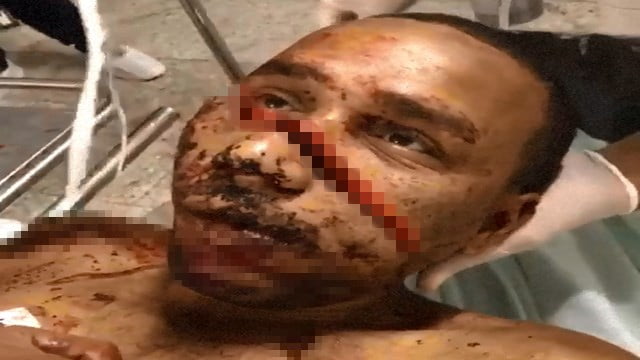 【閲覧注意】マチェットで顔面フルスイングされた男、こうなる。 | 閲覧注意グロ動画・衝撃映像のソルカブ