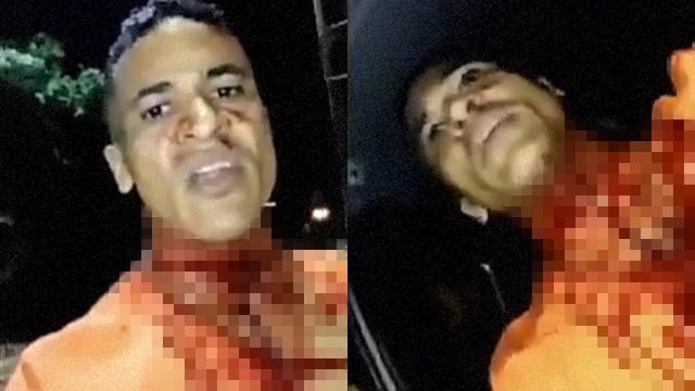【閲覧注意】凧糸で喉を切った男の自撮り動画。  |  閲覧注意グロ動画・衝撃映像のソルカブ