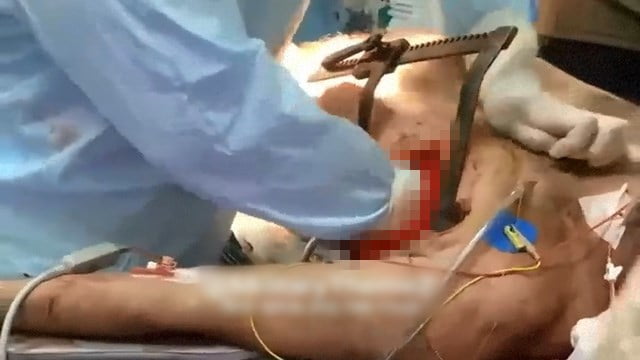 【戦争】ウクライナ 神の手を持つ ”心臓揉みの達人” が開胸マッサージを施す映像。 | 閲覧注意グロ動画・衝撃映像のソルカブ