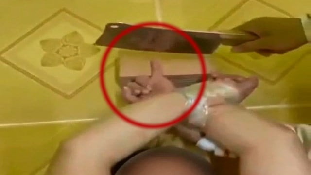 【閲覧注意】中国人女性、小指を切断される。  |  閲覧注意グロ動画・衝撃映像のソルカブ