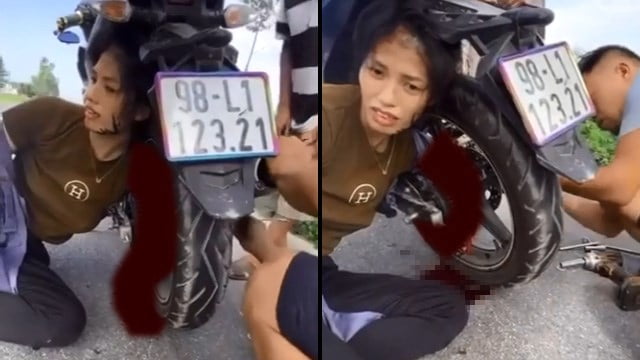 【閲覧注意】女性ライダーの腕がバイクの歯車に一周絡まる事故、痛々しすぎる… | 閲覧注意グロ動画・衝撃映像のソルカブ