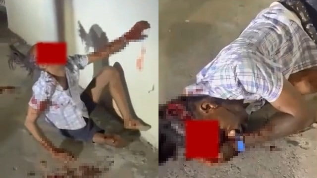 【閲覧注意】バイク事故の男性、これで生きてるのが信じられない… | 閲覧注意グロ動画・衝撃映像のソルカブ
