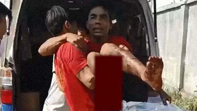 【閲覧注意】地雷を踏んだミャンマー人、足を失う。 | 閲覧注意グロ動画・衝撃映像のソルカブ