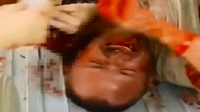 【閲覧注意】ウクライナの野戦病院で「命救う」闘い。気管挿管のスゴ技動画。 | 閲覧注意グロ動画・衝撃映像のソルカブ