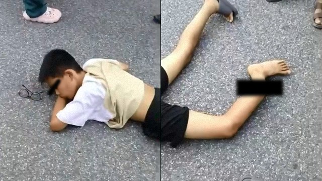 【事故】救急車に足を折られたバイク少年（動画）  |  閲覧注意グロ動画・衝撃映像のソルカブ