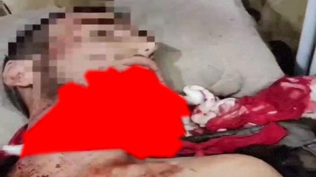 【閲覧注意】ウクライナから帰ってきたロシア兵の顔、もうムチャクチャ…（動画） | 閲覧注意グロ動画・衝撃映像のソルカブ