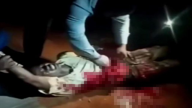 【閲覧注意】南スーダン人の男性が「腸をお腹に戻される」動画。エグすぎ… | 閲覧注意グロ動画・衝撃映像のソルカブ
