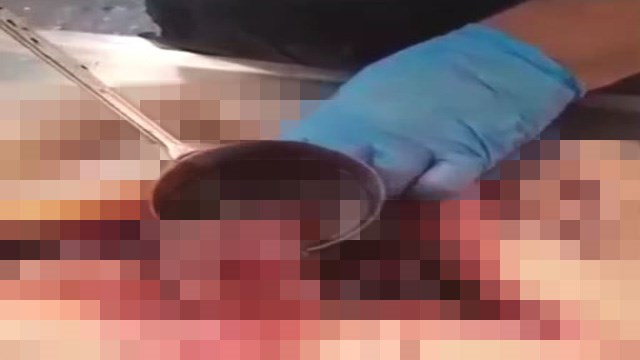 【閲覧注意】剖検台のプロが教える「上手なスープの掬い方」※スープは比喩表現です。 | 閲覧注意グロ動画・衝撃映像のソルカブ